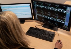 Radiologie thuiswerkplek diagnostische monitor