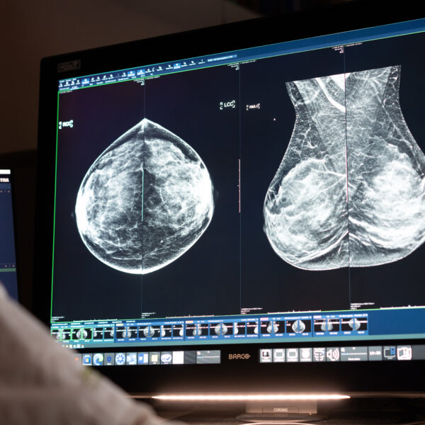 De juiste diagnostische monitor voor thuiswerkende radiologen: waar let je op?