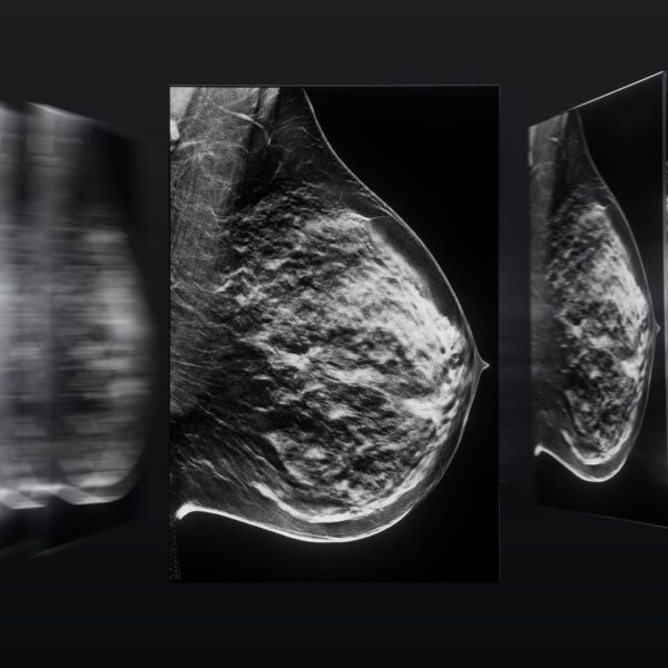 Borstbeeldvorming naar een hoger niveau